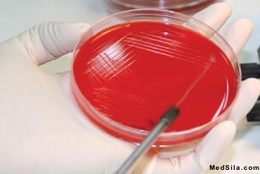 no alt var
